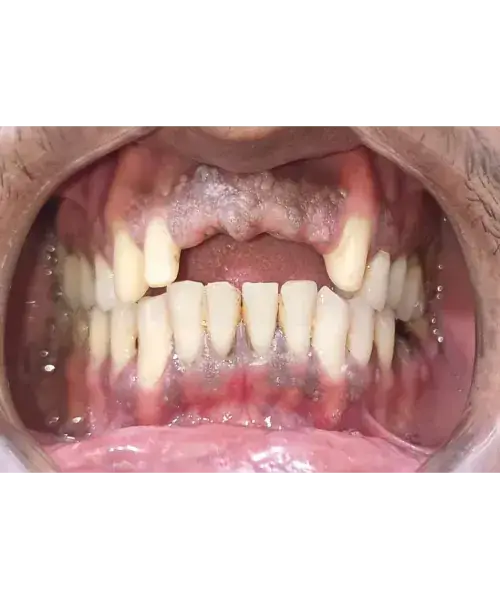 Smile transformation 2 — before treatment
