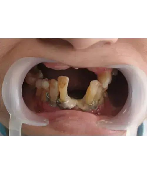 Smile transformation 3 — before treatment