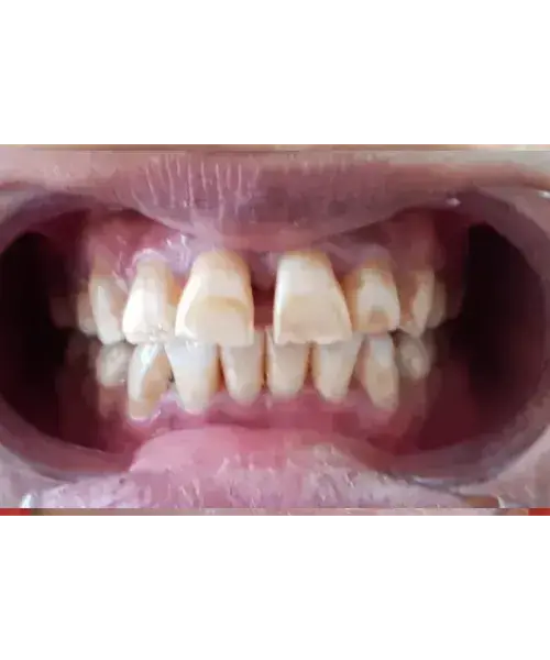 Smile transformation 5 — before treatment